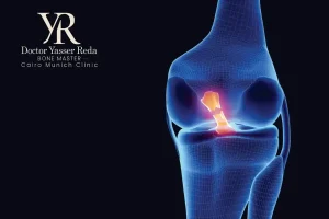 أسباب تمزق الرباط الصليبي