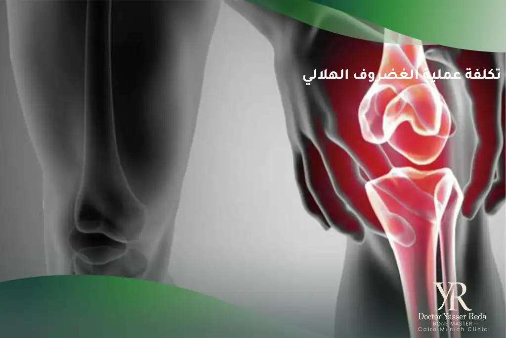 تكلفة عملية الغضروف الهلالي