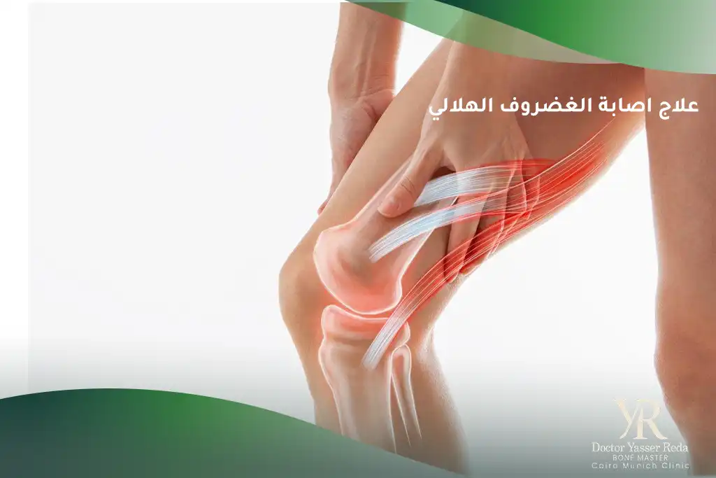 علاج اصابة الغضروف الهلالي