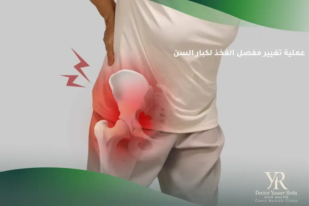 عملية تغيير مفصل الفخذ لكبار السن