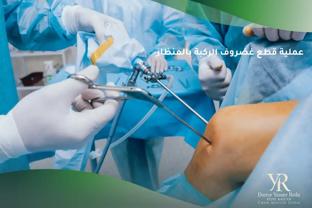 عملية قطع غضروف الركبة بالمنظار