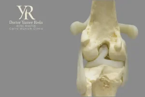 نسبة نجاح عملية الرباط الصليبي