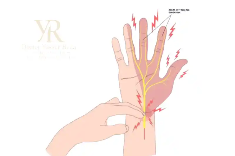 طرق علاج الاصبع الزنادي
