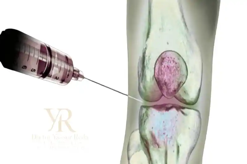 طريقة حقن مفصل الركبة