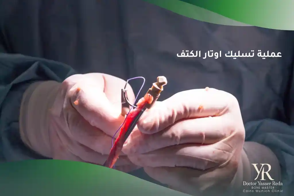 عملية تسليك اوتار الكتف