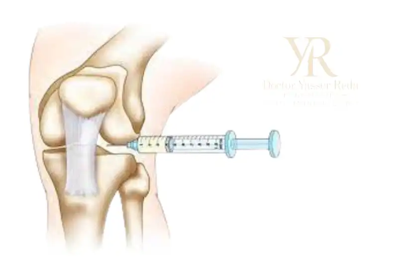 فوائد حقن الجيلاتين للمفاصل