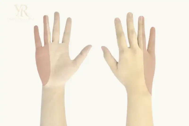 أعراض اعتلال العصب الزندي