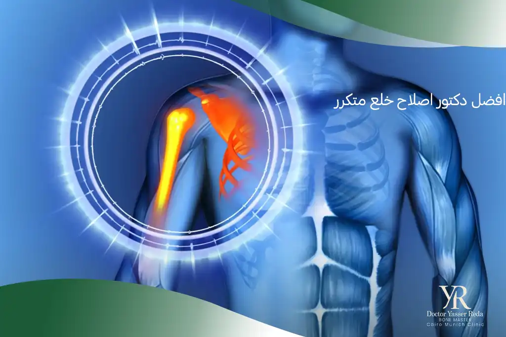 افضل دكتور اصلاح خلع متكرر