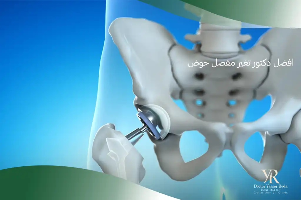 افضل دكتور تغير مفصل حوض