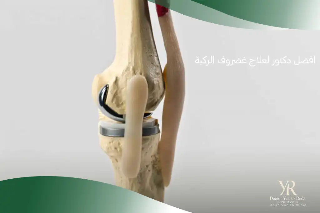 افضل دكتور تغيير مفصل الركبة في مصر