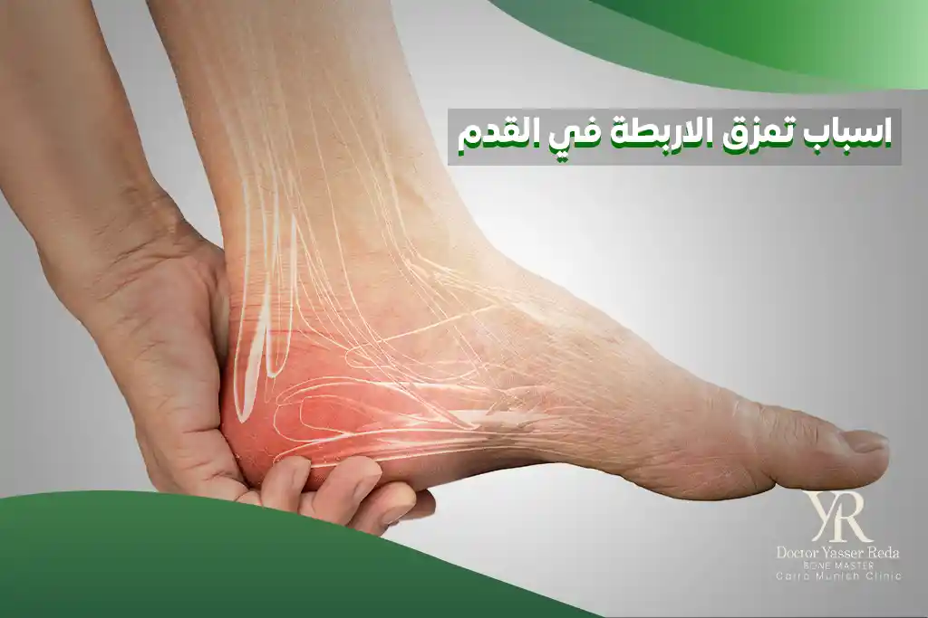 اسباب تمزق الاربطة في القدم