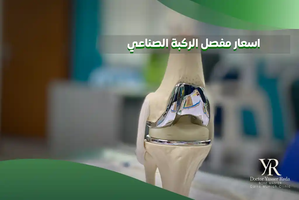 اسعار مفصل الركبة الصناعي