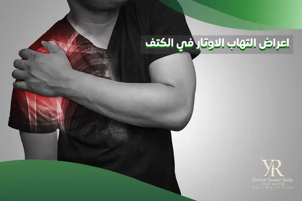 اعراض التهاب الاوتار في الكتف