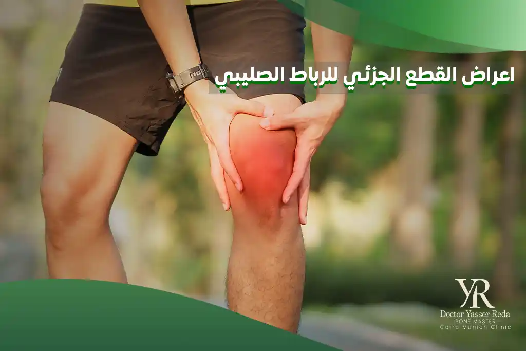 اعراض القطع الجزئي للرباط الصليبي