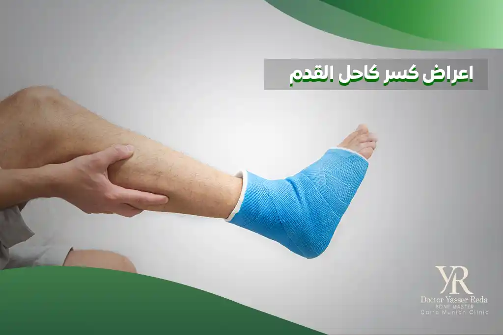 اعراض كسر كاحل القدم