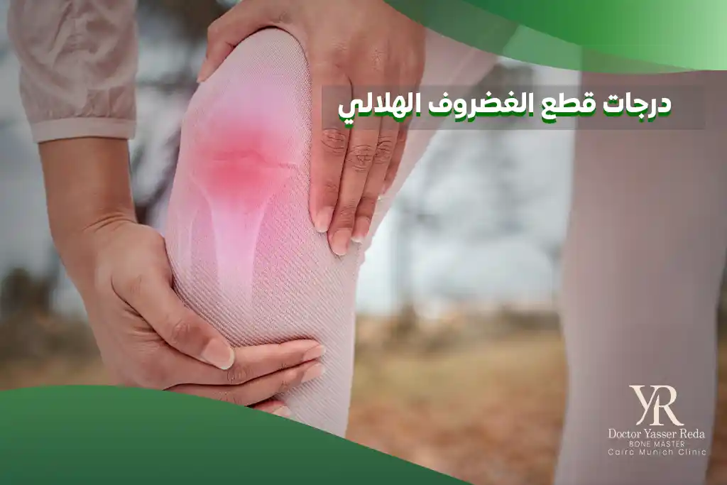 درجات قطع الغضروف الهلالي