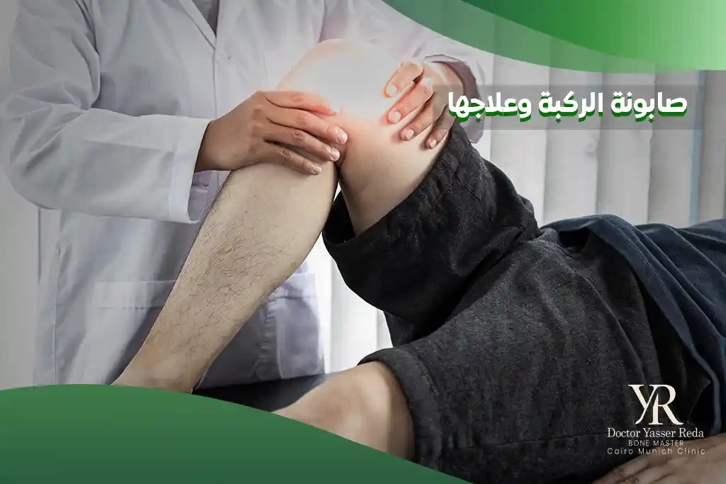 صابونة الركبة وعلاجها