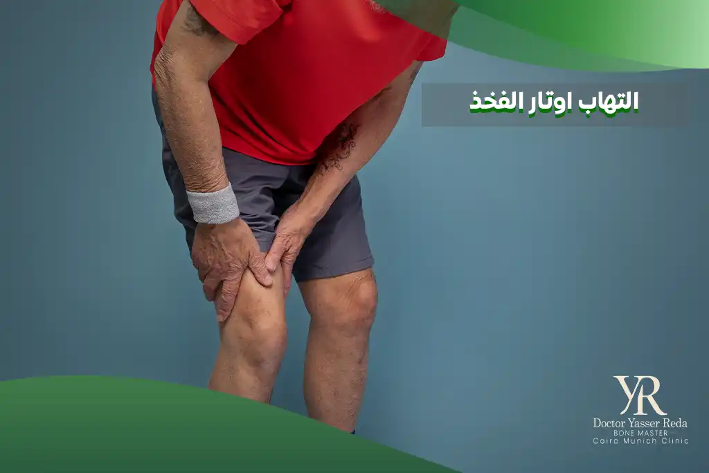 التهاب اوتار الفخذ