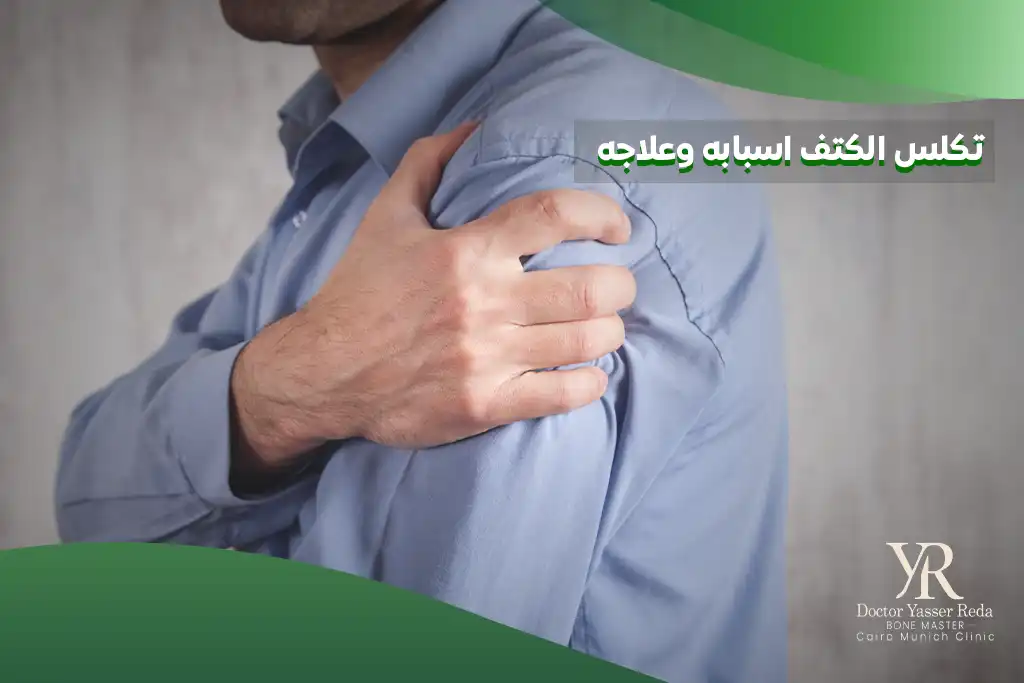 تكلس الكتف اسبابه وعلاجه