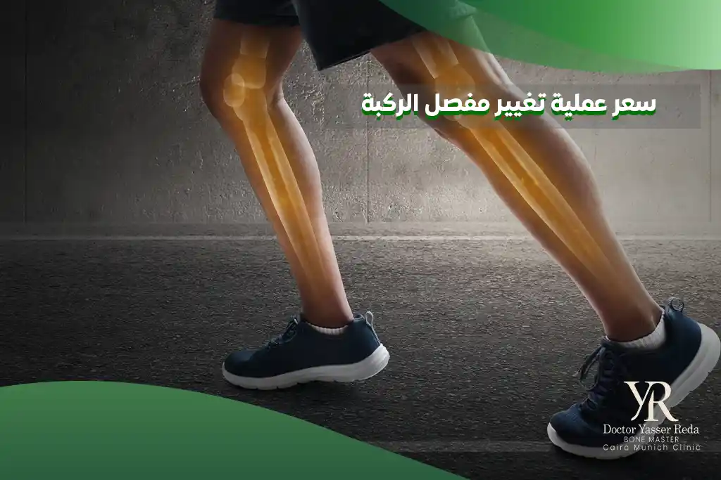 سعر عملية تغيير مفصل الركبة